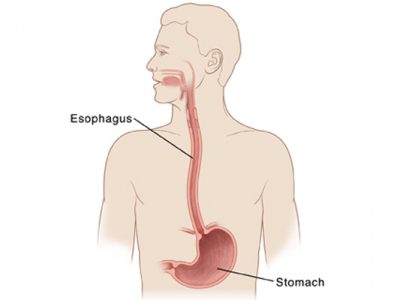 esophagus-and-stomach-disease