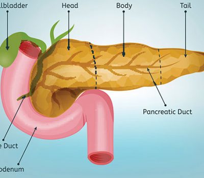 pancreatobiliary-disease